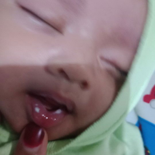 bibir putih putih