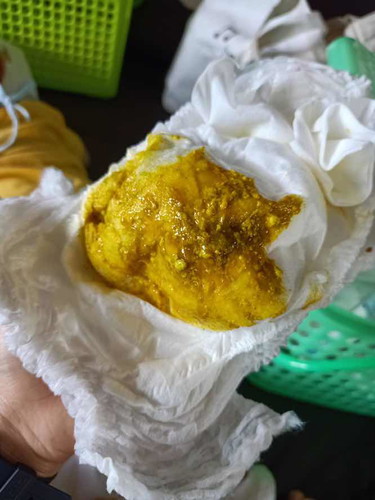 ลูกถ่ายเป็นมูกหลังจากกินนมแม่ล้วน (เมื่อก่อนกินนมผง)