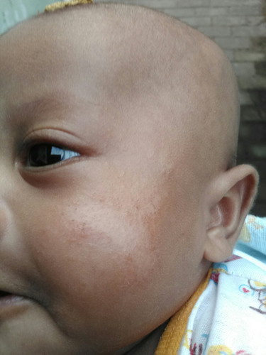 kena air susu