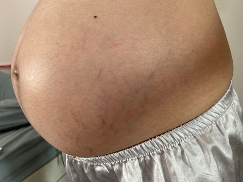 รอยแตกลาย