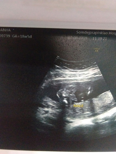 บ้านไหนชอบโชว์จู๋ให้หมอและพี่พยาบาลดูบ้างจ้า