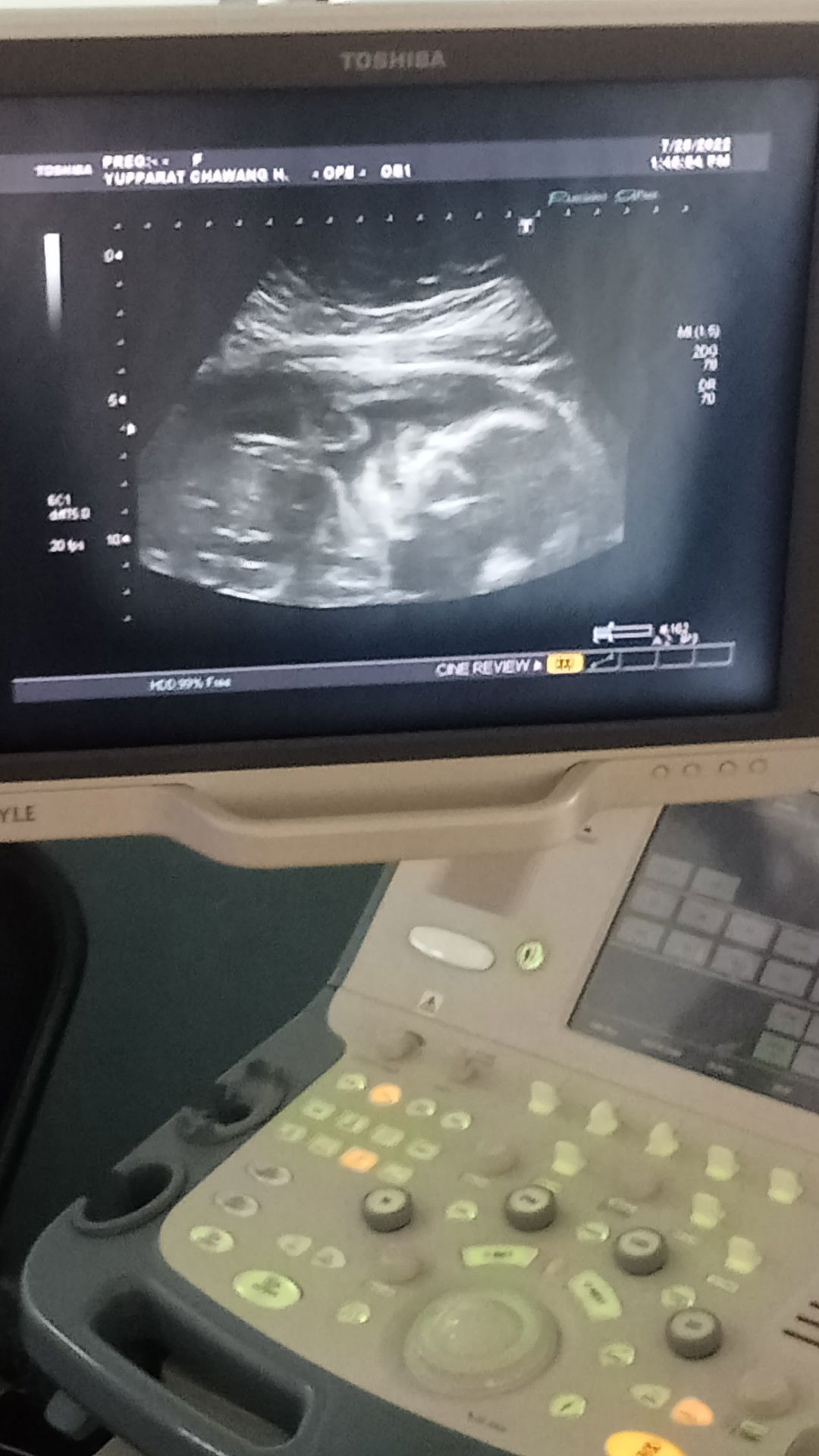 เรย์ profile icon