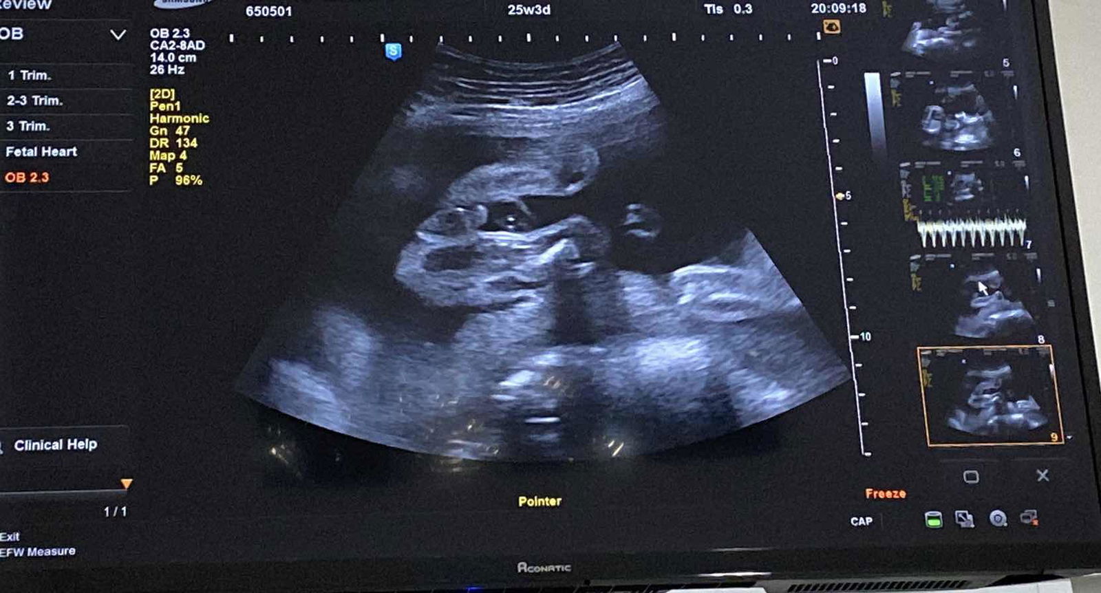 ผมเพศชาย 100% ครับคุณหมอบอก