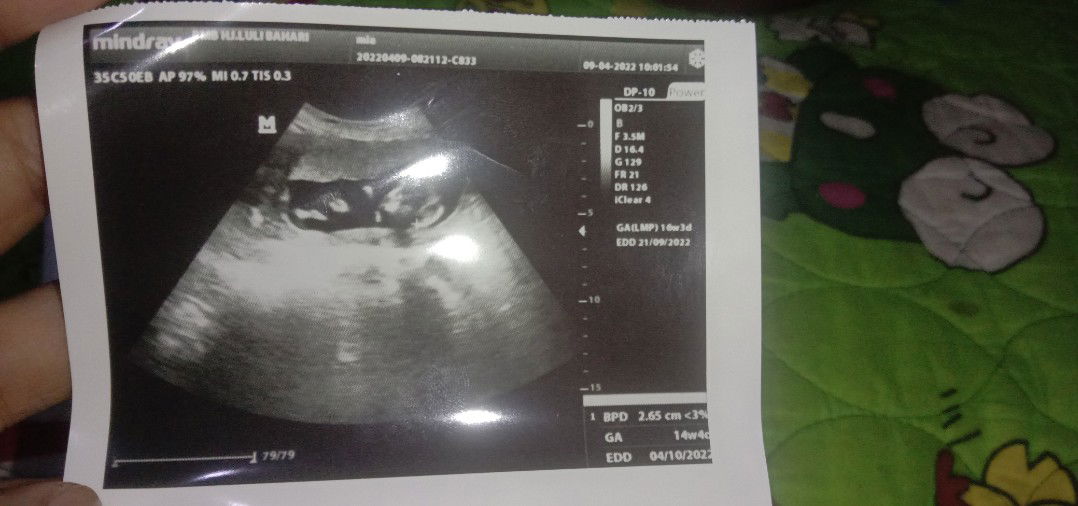 Mia alisa Aprilia profile icon