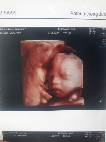 ซาวด์สี่มิติ24week