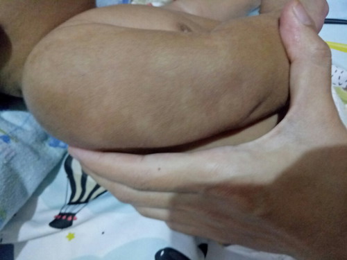 warna kulit yg berbeda