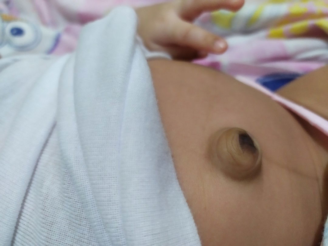 pengalaman pusar bodong seperti ini