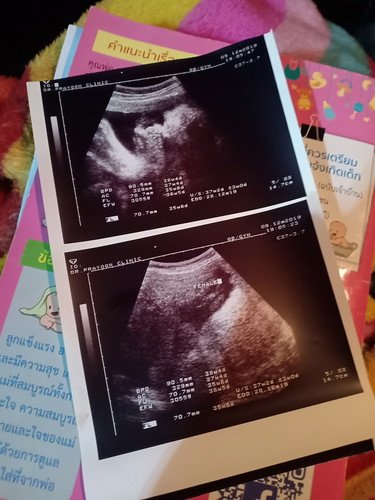 36week