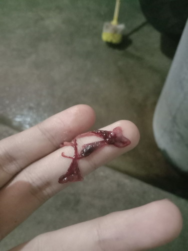 แท้งรึป่าวคะ