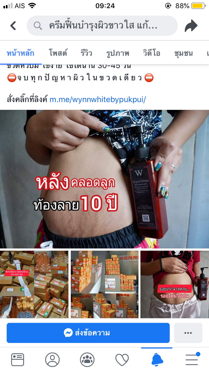 ครีมทาท้องตัวนี้ดีมั้ยคะ พอดีเห็นในเฟส