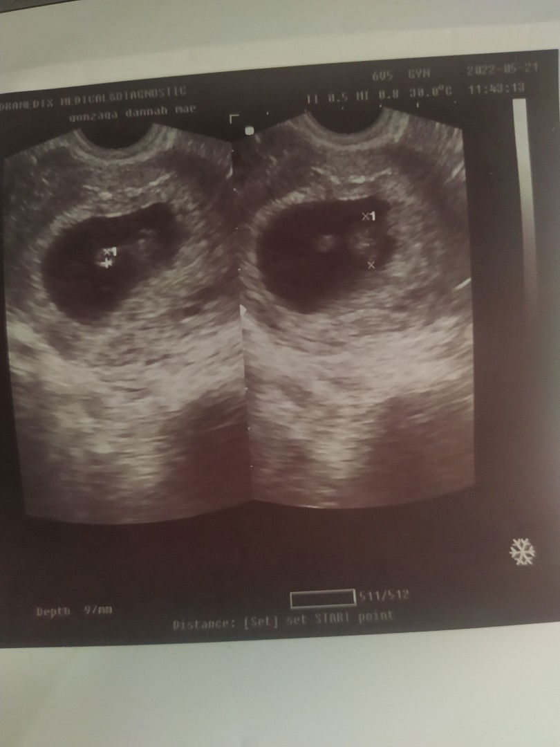 Dannah Mae Gonzaga profile icon