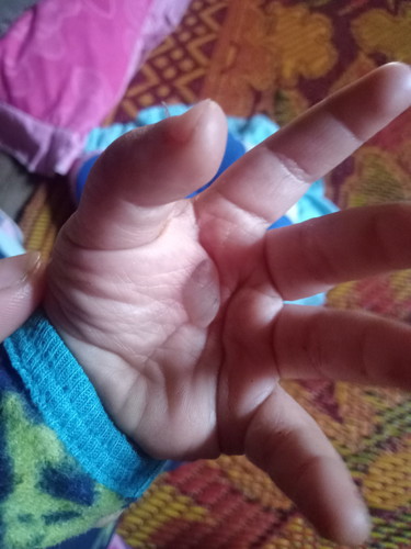 มีวิธีรักษายังไงบ้าง