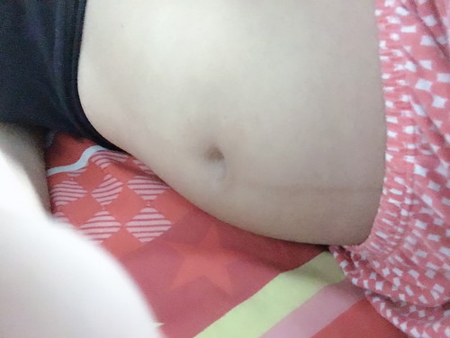 21สัปดาห์แล้วยังไม่รู้ลูกดิ้นเลย ท้องเล็กมาเหมือนไม่ไดท้อง