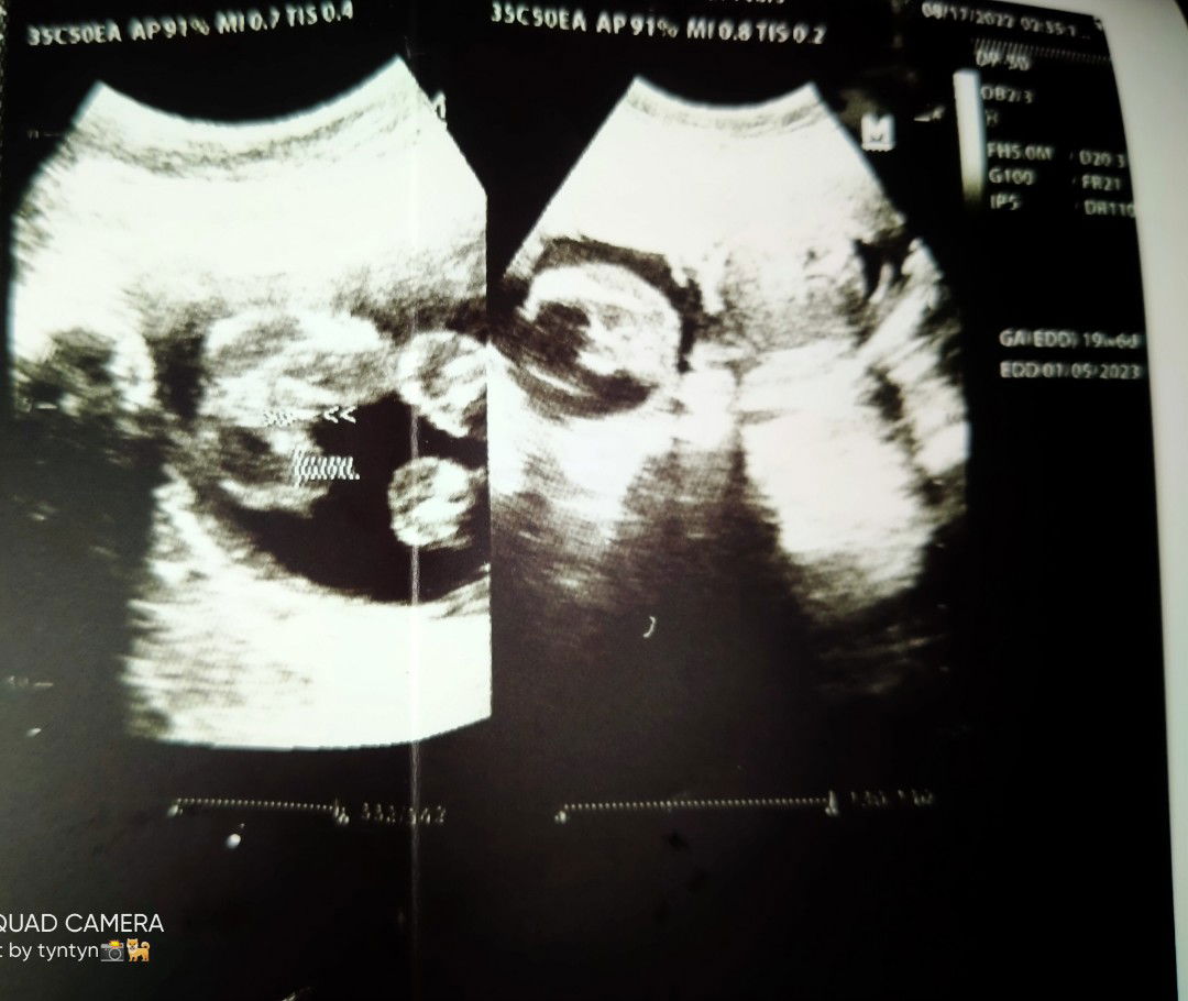 Mylch Godyrine Marfil profile icon