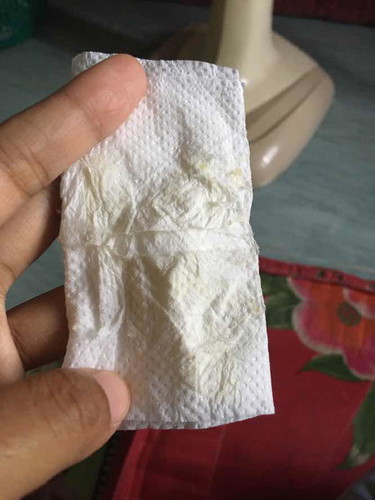 น้ำไหลช่องคลอด