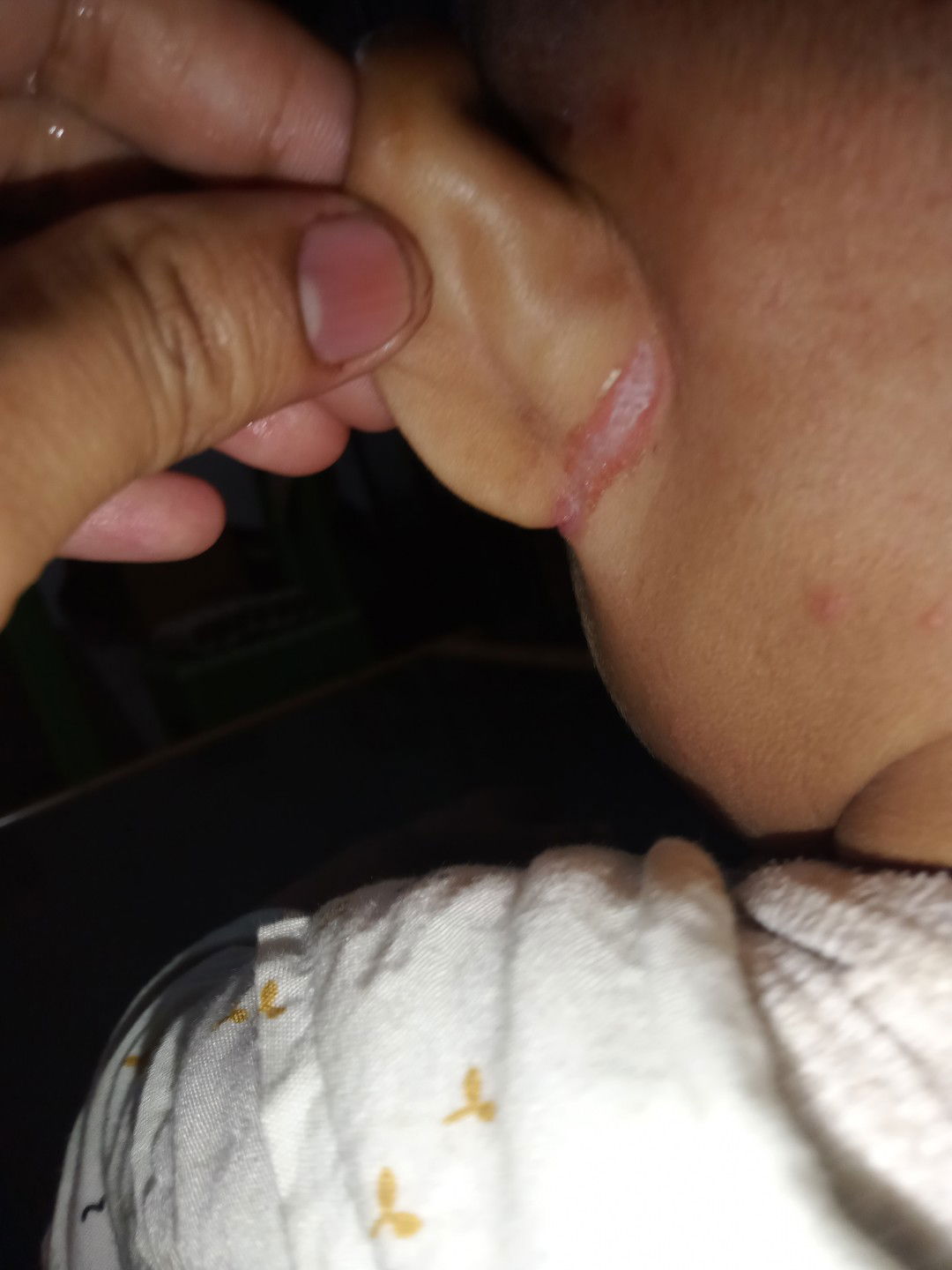 Daun Telinga iritasi ada benjolan di belakang telinga dan kayak bisul di kepala