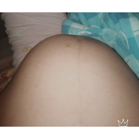 กำหนดคลอด