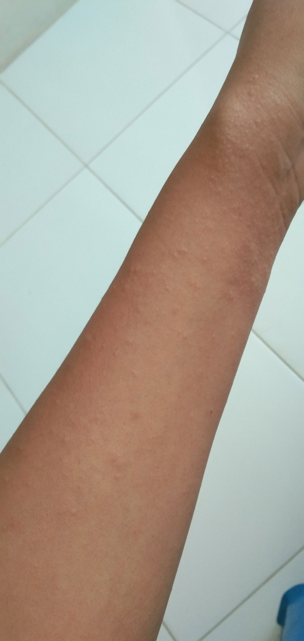 gatel² seluruh badan