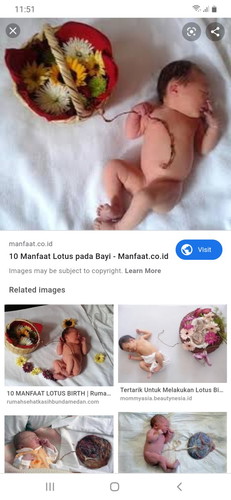 share pengalaman yang pernah lotus birth