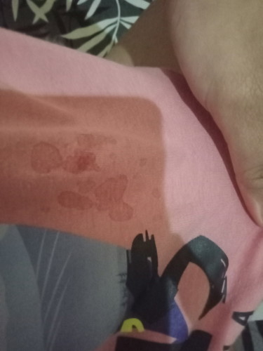 Hamil 24 Minggu Asi sudah keluar