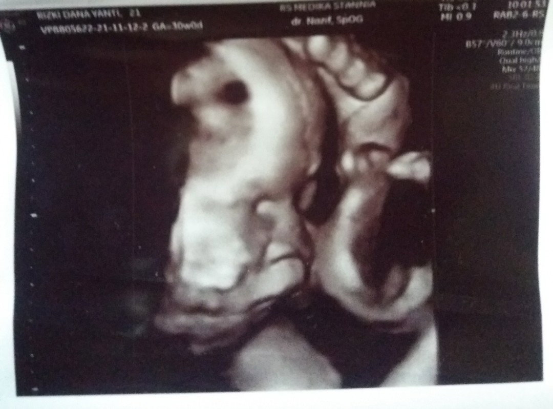 Hii Riskii profile icon