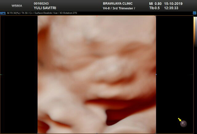 khawatir dan bingung