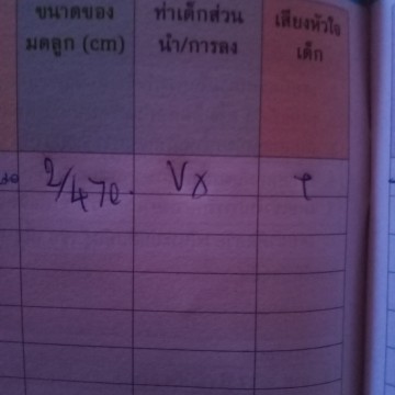 หมอเขียนแบบนี้น้องอยู่ท่าอะไรคะ