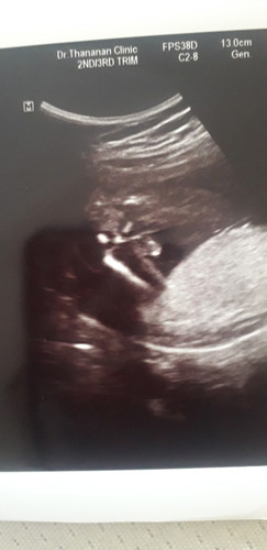 ช่วยดูหน่อยค่ะ