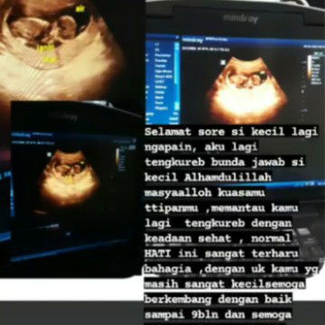 Khusni hidayatun profile icon