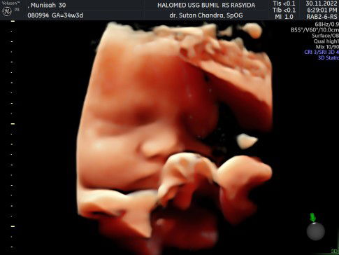 Nisya Sha Munisyah profile icon