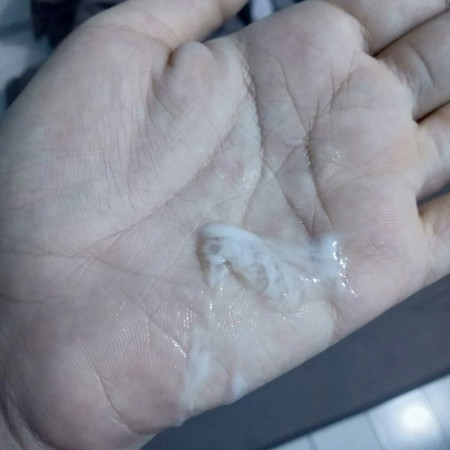 แบบนี้ใช่ตกขาวไหมค่ะ