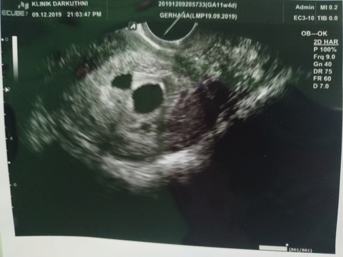 innalillahi wa innailaihi rojiun..