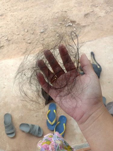 ผมร่วงหนักมากดด