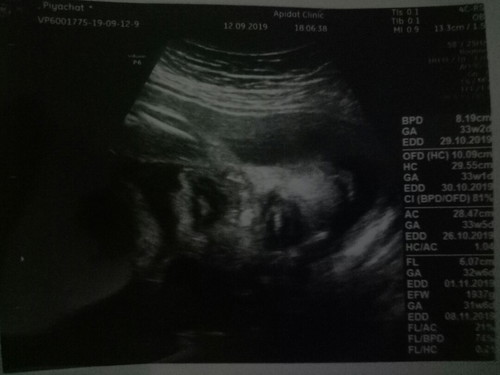 ภาพซาว2มิติ