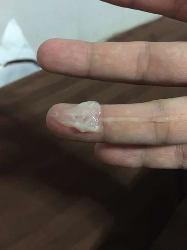 อาการแบบนี้คืออะไรคะ ?