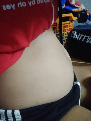 3เดือนเเล้วยังท้องเล้กอยุ่เลยแพ้เป็นผื่นเยอะเลยค่ะ