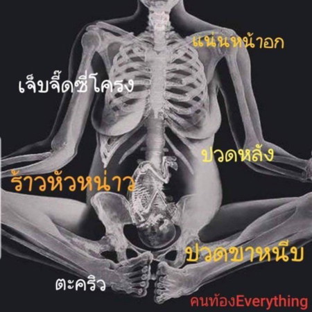 ความเจ็บปวดที่งดงาม