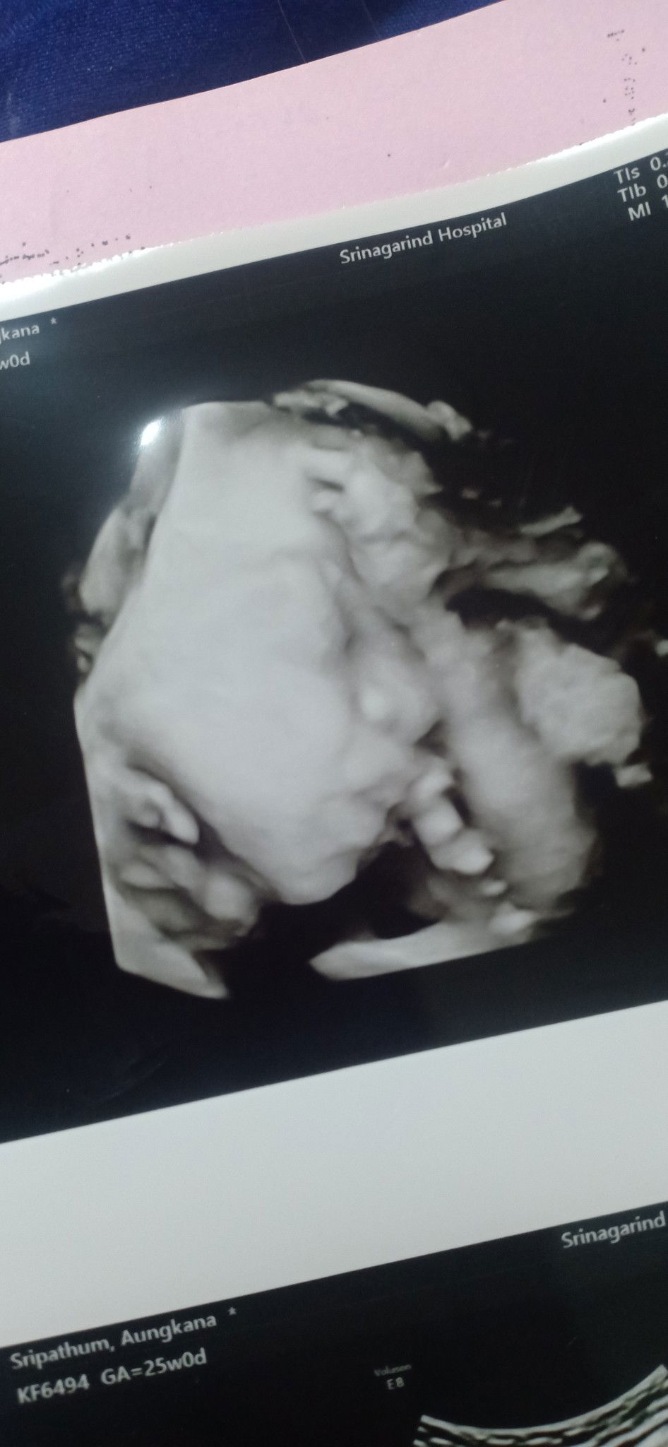 อังคณา ศรีทุมมา profile icon