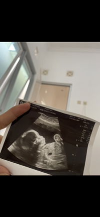 Frida Nur Kosasih profile icon