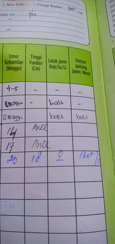 ini artinya apa ya bund?