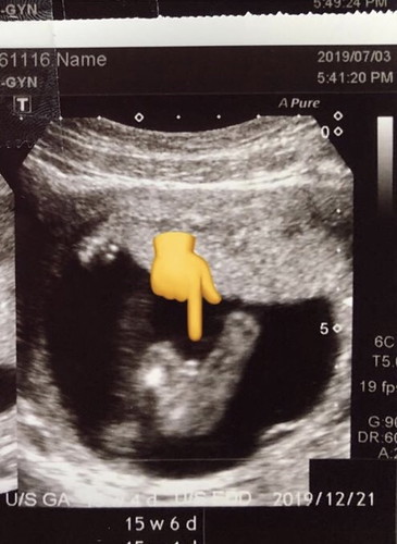 ช่วยดูหน่อยผญ หรือ ผช คะ