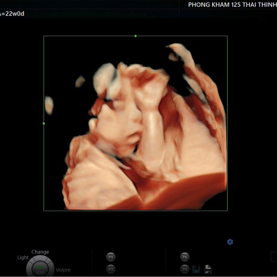 Có mom nào dks 15-16/1 k ạ