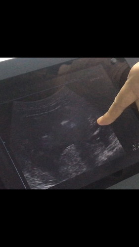 ได้ลูกสาวววว กรี้ดมากก?
