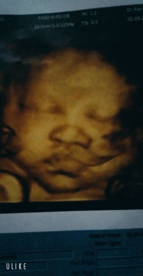 รักเจ้าตั้งแต่ตั้งไข่