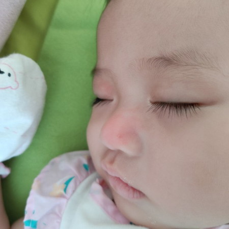 น้องแพ้มดค่ะ