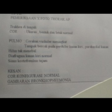 Hasil ronsen