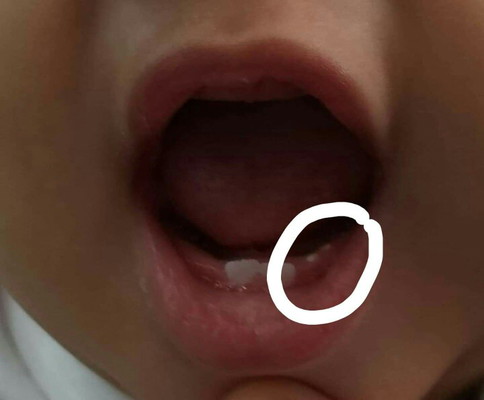 น้อง7 เดือน