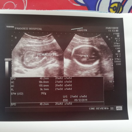 หมอบอกว่าเหมือนผู้หญิง