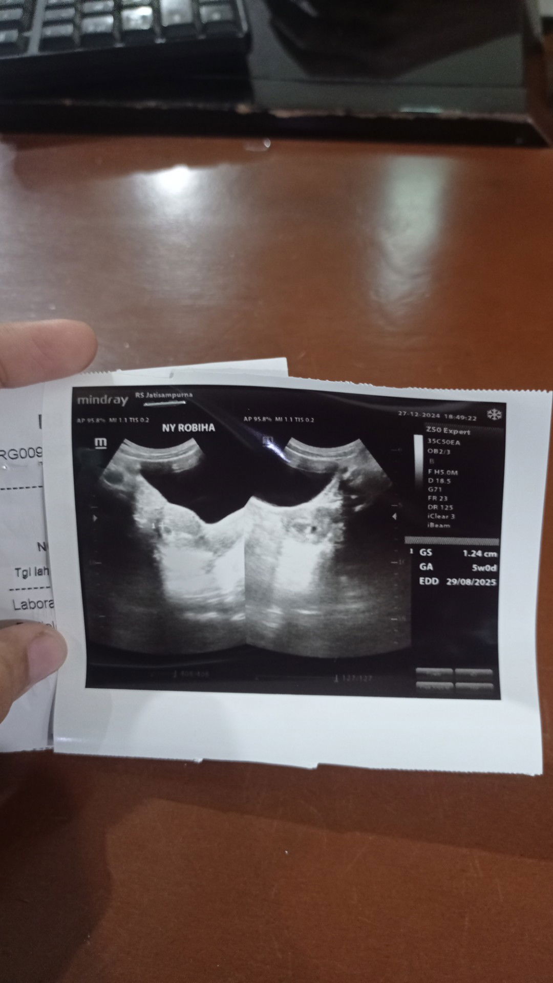 5 Minggu Kelua darah dan flek