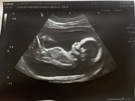 Purilak Lim profile icon